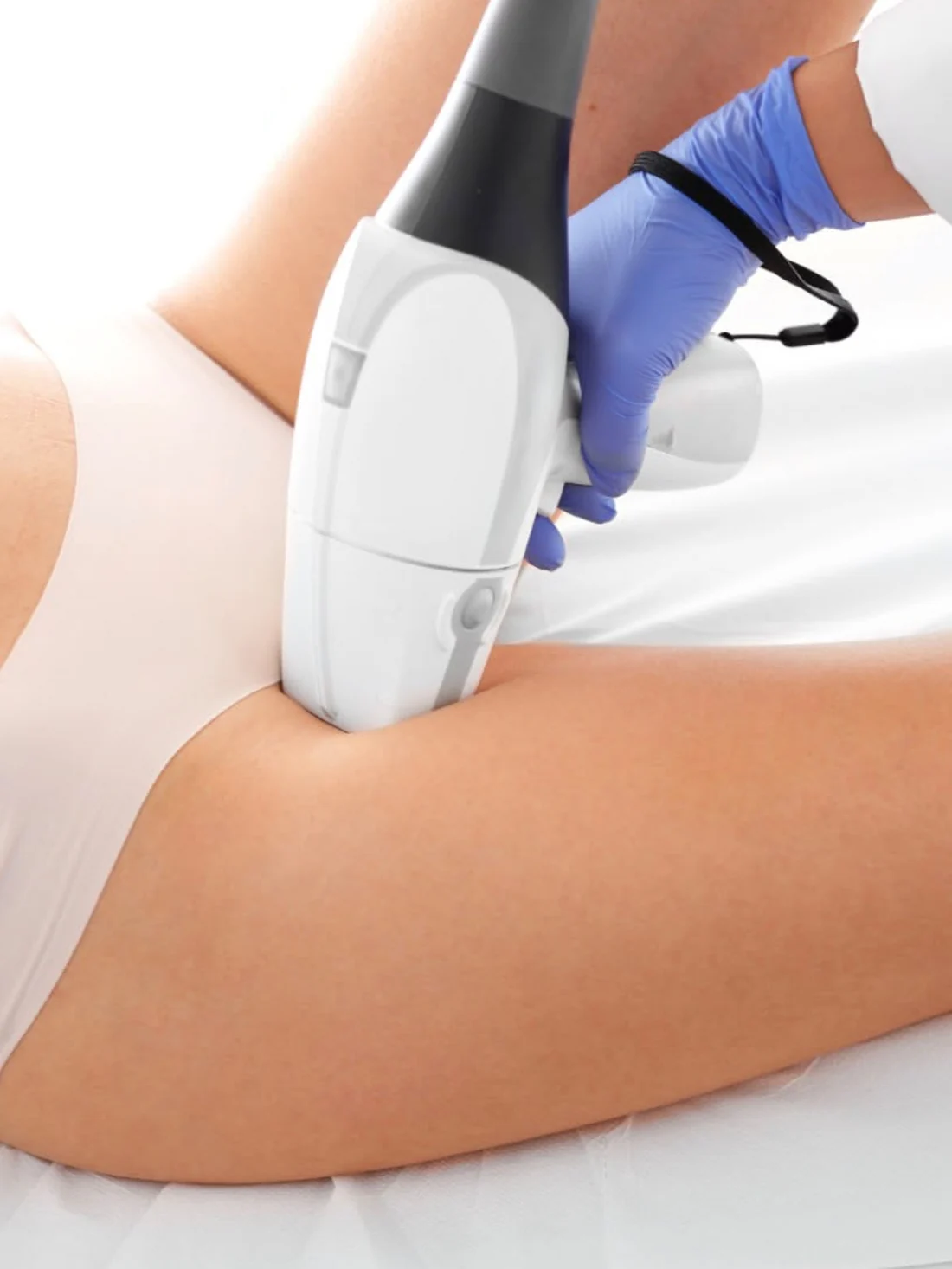 Dauerhafte Haarentfernung mit dem Diodenlaser